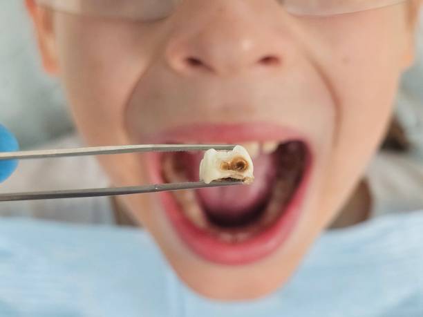 Best Broken or Cracked Tooth Emergency Dentist in Hartley, IA